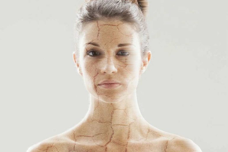 آخرین فناوری درمان پیری پوست: سوف ویو، مورفئوس۸ یا پوتنزا؟